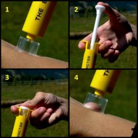 Sawyer Bite & Sting Kit