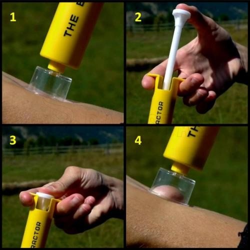 Sawyer Bite & Sting Kit